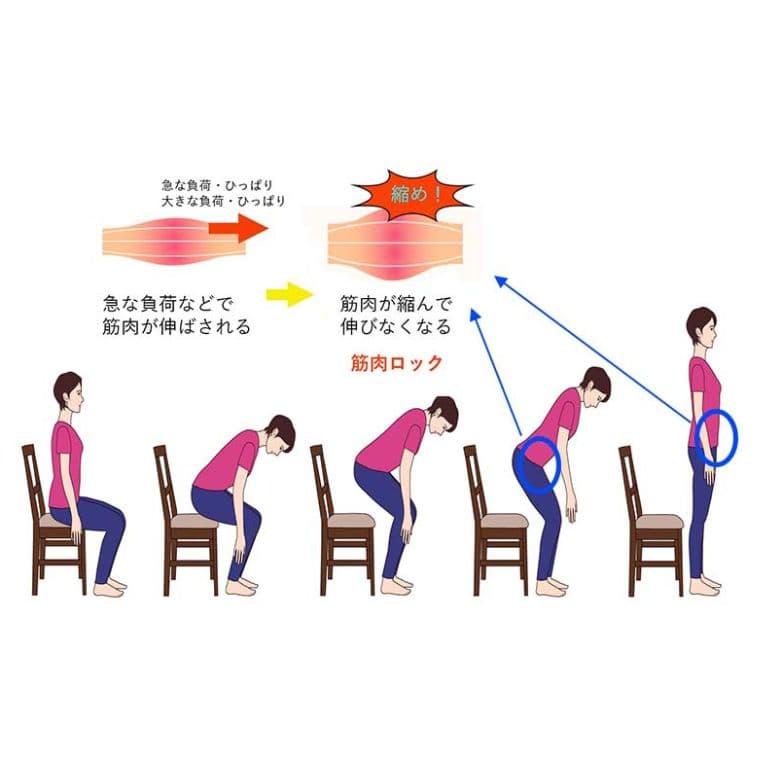 筋肉ロックはからだの防衛反応