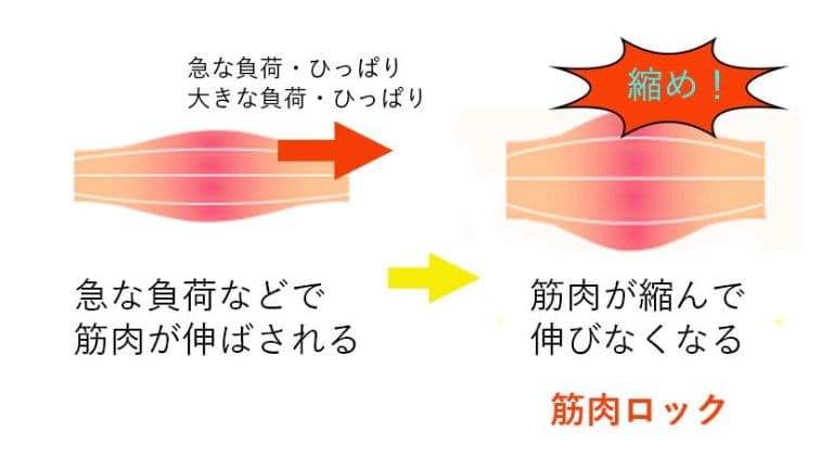 そもそも筋肉ロックとは？