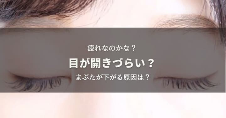 目が開きづらい？まぶたが下がる原因は？のイメージ画像