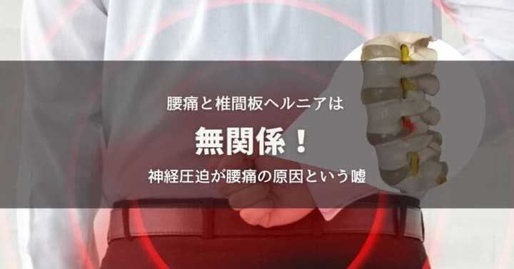 腰痛と椎間板ヘルニアは無関係！ヘルニアによる神経圧迫が腰痛という嘘のイメージ画像