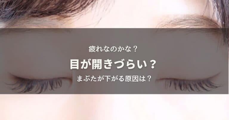 目が開きづらい？まぶたが下がる原因は？
