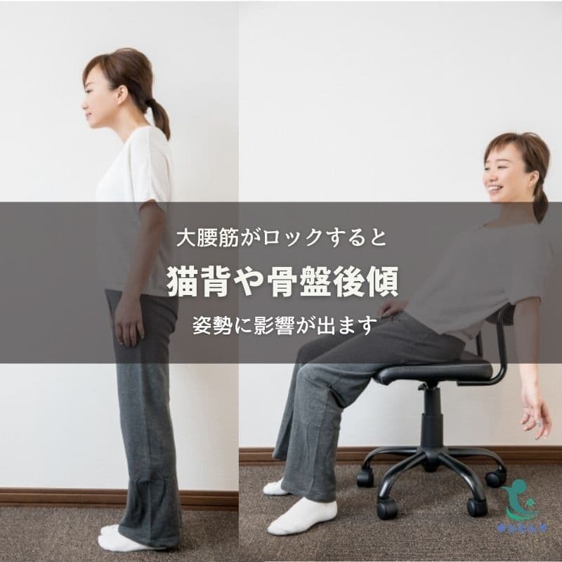 猫背や反り腰の原因は大腰筋のロック!?