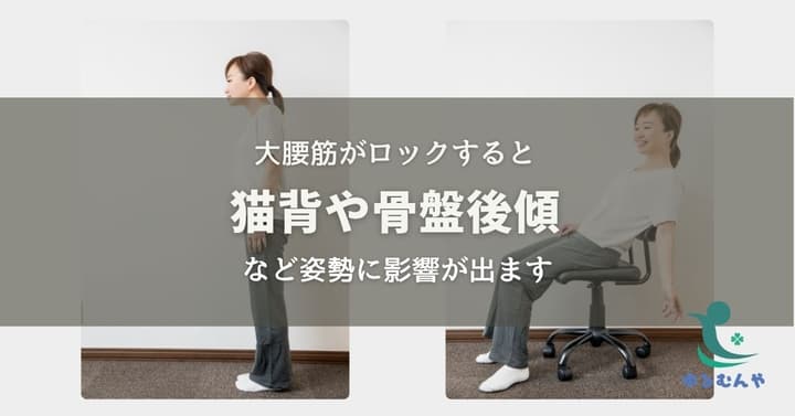 猫背や反り腰の原因は大腰筋のロックのイメージ画像