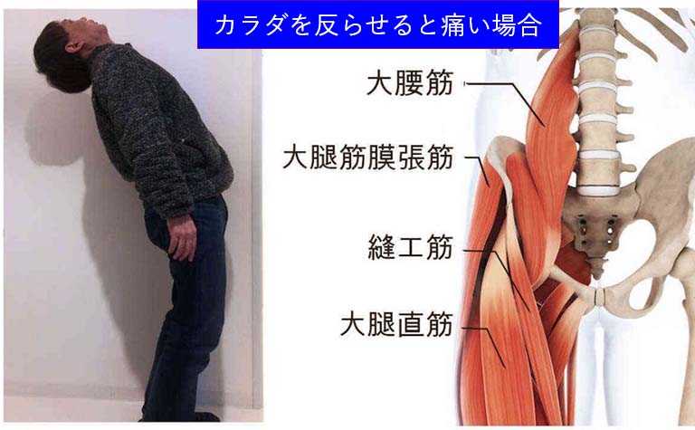 腰痛の方は体を反らせづらい