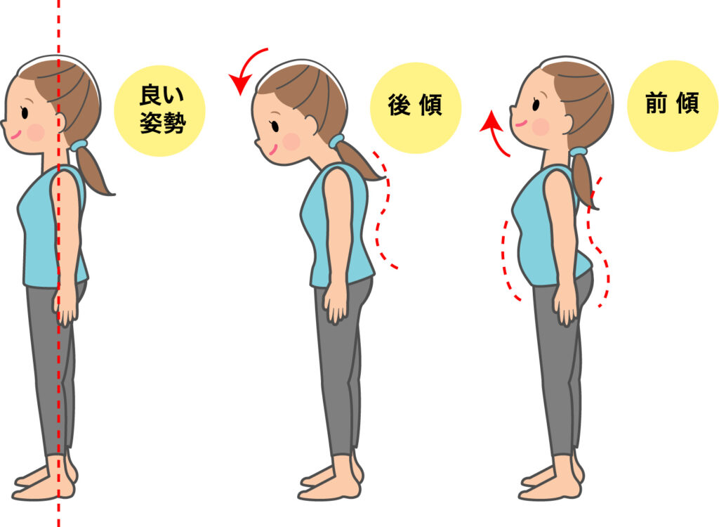 猫背や骨盤のゆがみ