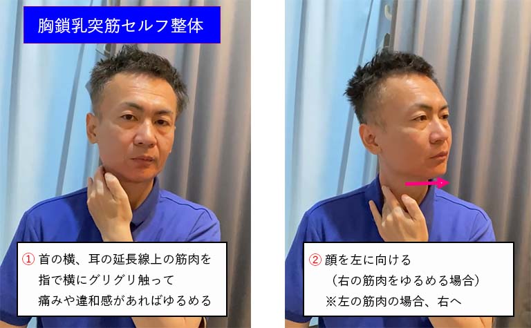 胸鎖乳突筋セルフ整体1