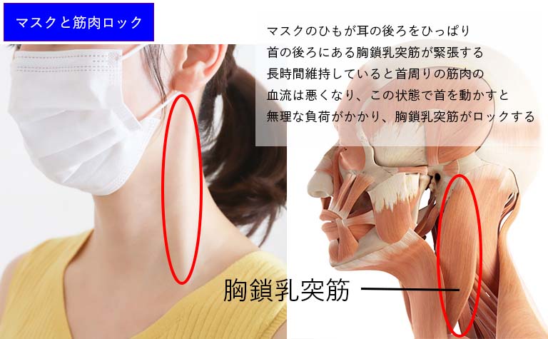 マスクと胸鎖乳突筋のロック