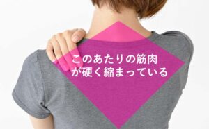 肩甲骨まわりの僧帽筋という筋肉が硬く縮まっている