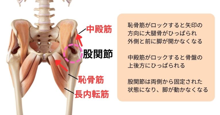 股関節が動かなくなる原因1